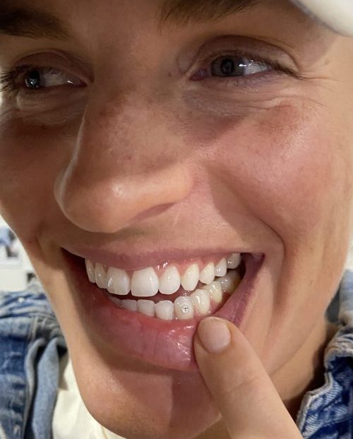 Lower Tooth Gem scaled e1716246209602